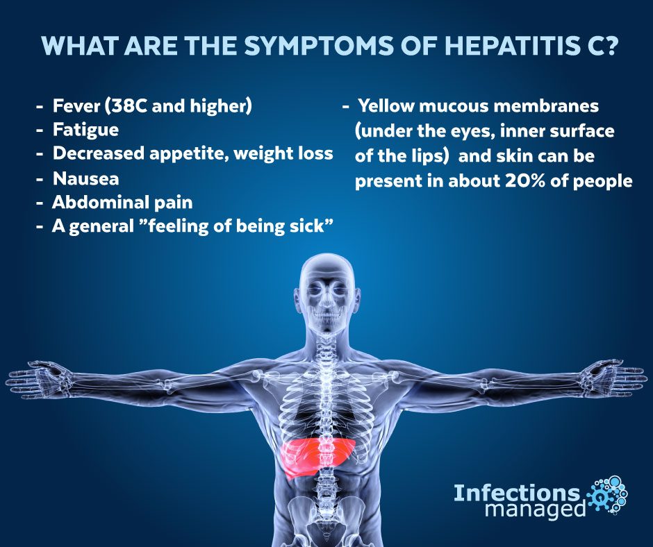 Hepatitis C